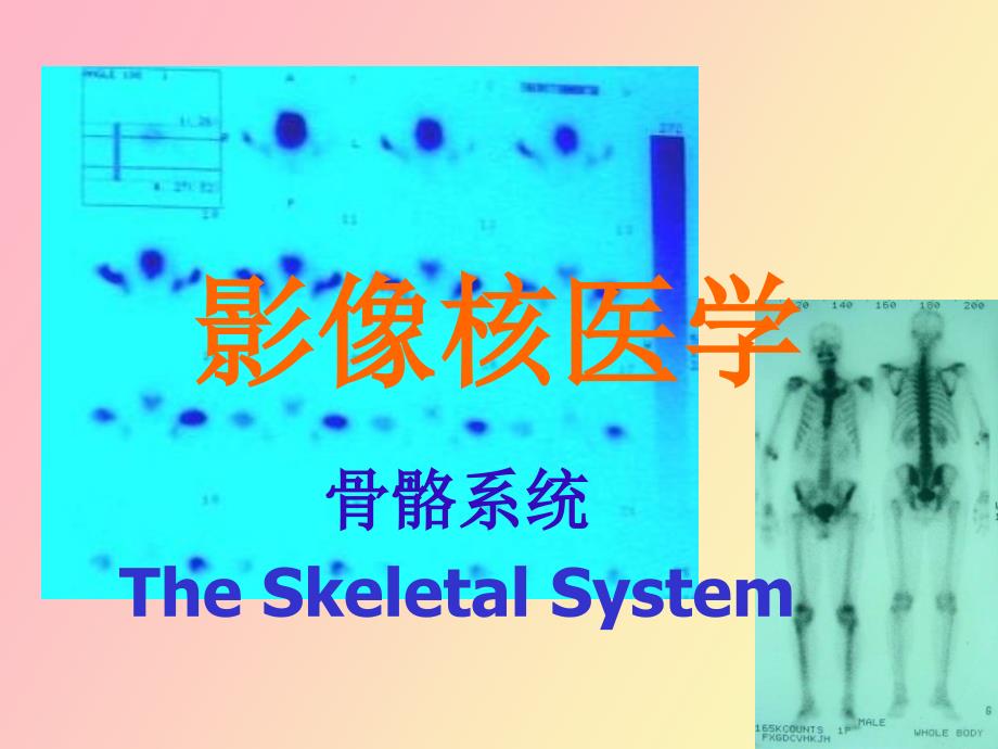 核医学骨骼系统_第1页