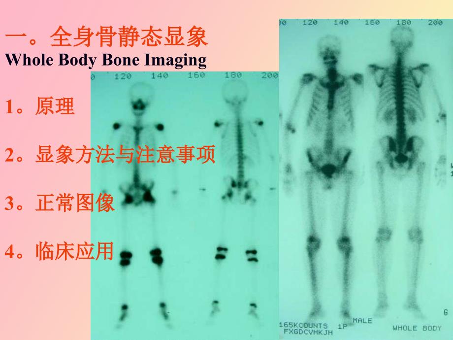 核医学骨骼系统_第3页