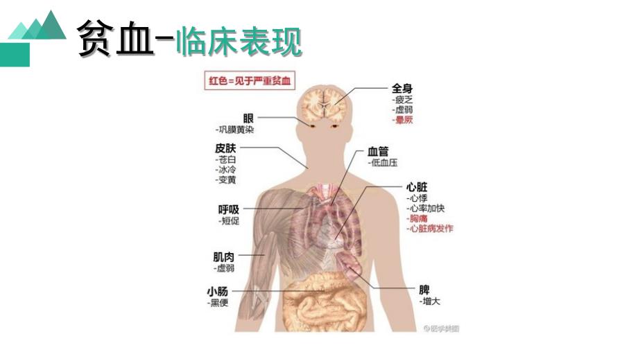 白血病临床表现课堂PPT_第3页