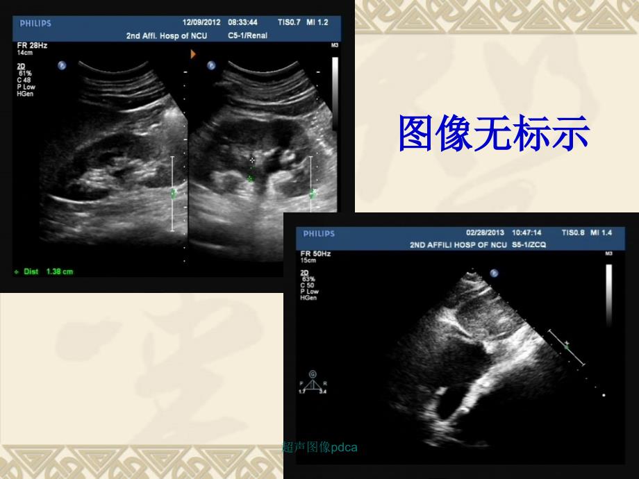 最新超声图像pdca_第3页