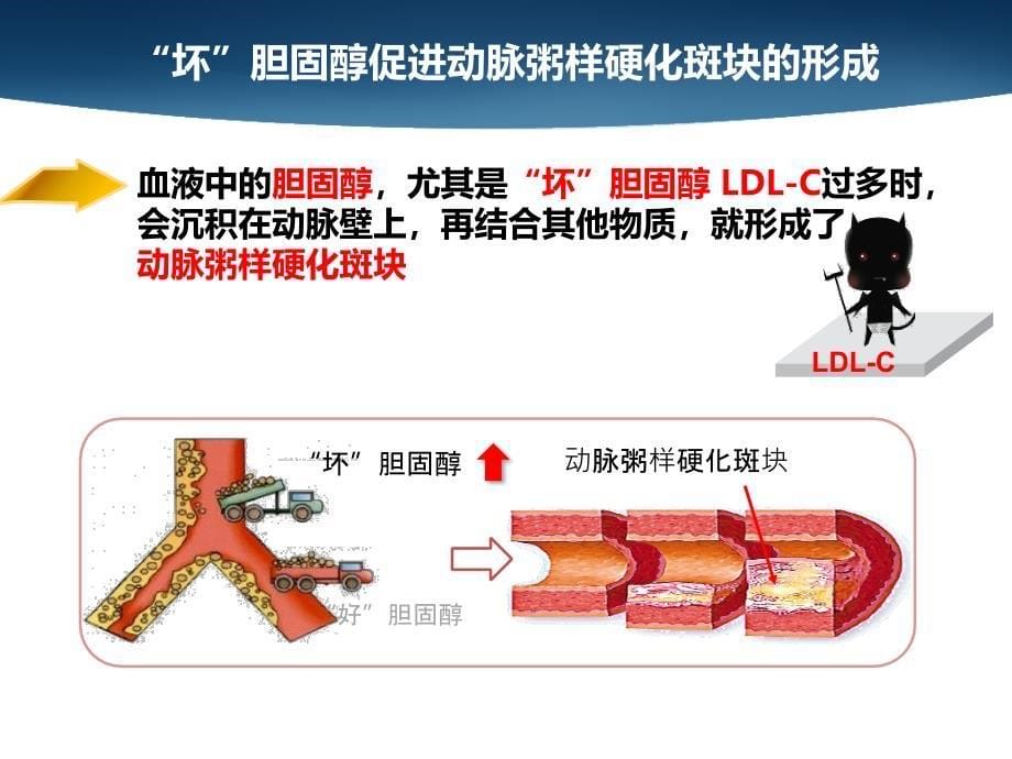 如看懂血脂化验单？_第5页