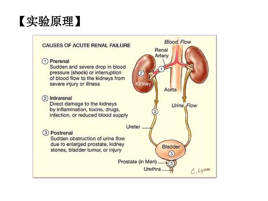 急性肾功能衰竭及药物的影响_第3页