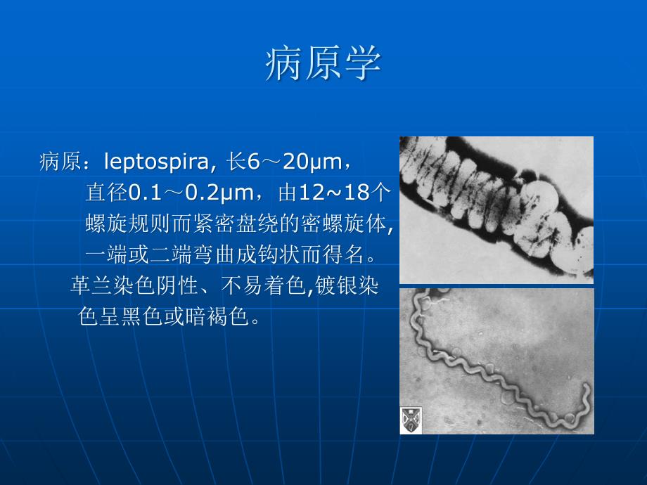 传染病学：钩端螺旋体病_第4页