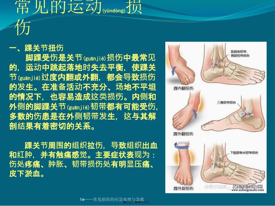 hw----常见损伤的应急处理与急救课件_第2页