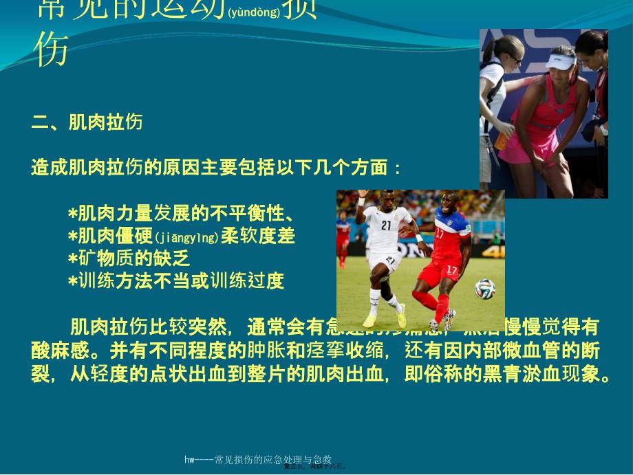 hw----常见损伤的应急处理与急救课件_第3页