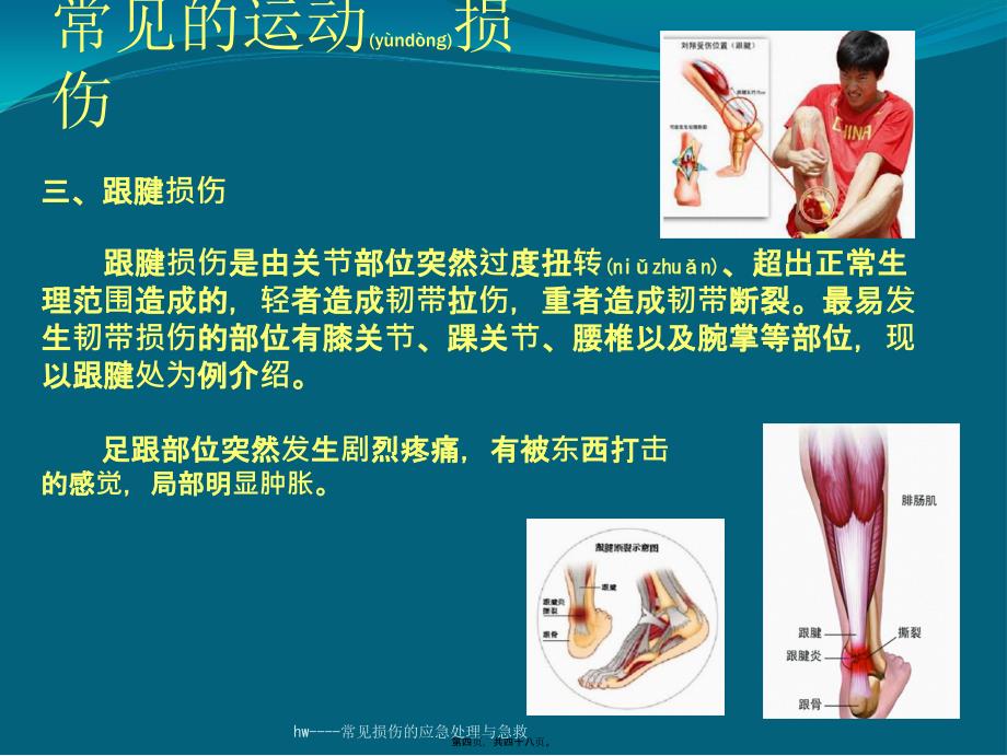 hw----常见损伤的应急处理与急救课件_第4页