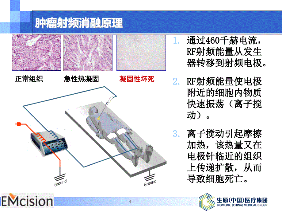 《胆道射频消融技术》PPT课件_第4页