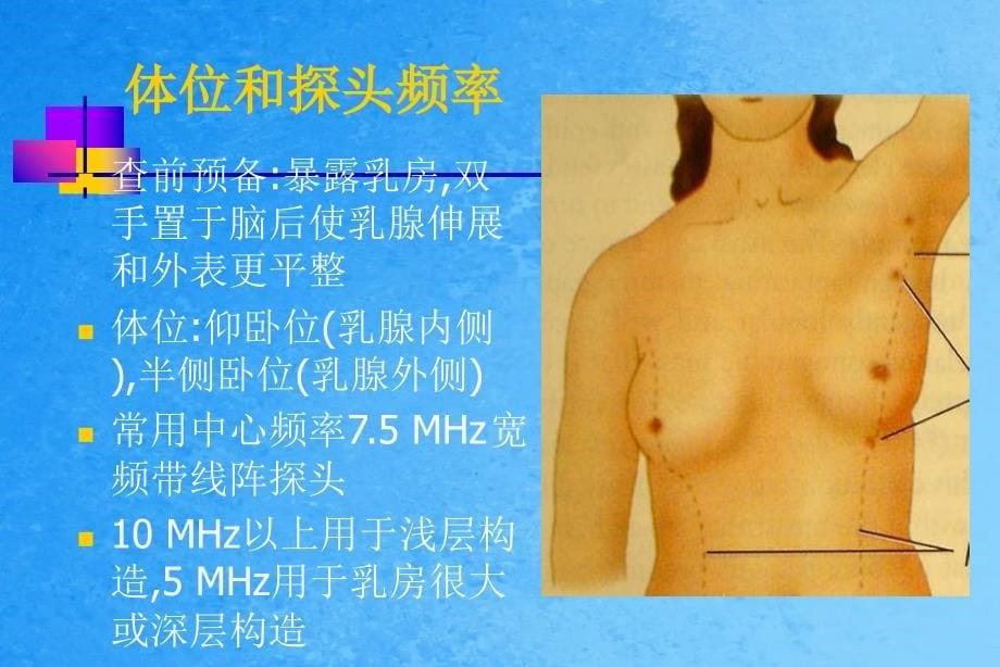 乳腺超声ppt课件_第5页