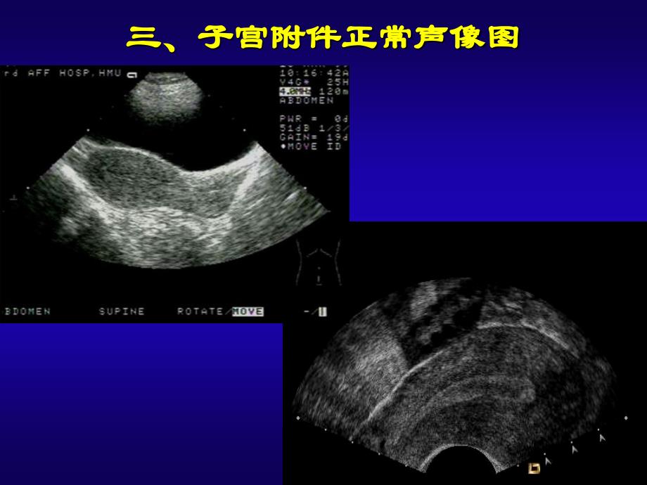 妇产科超声口腔本科.ppt_第4页