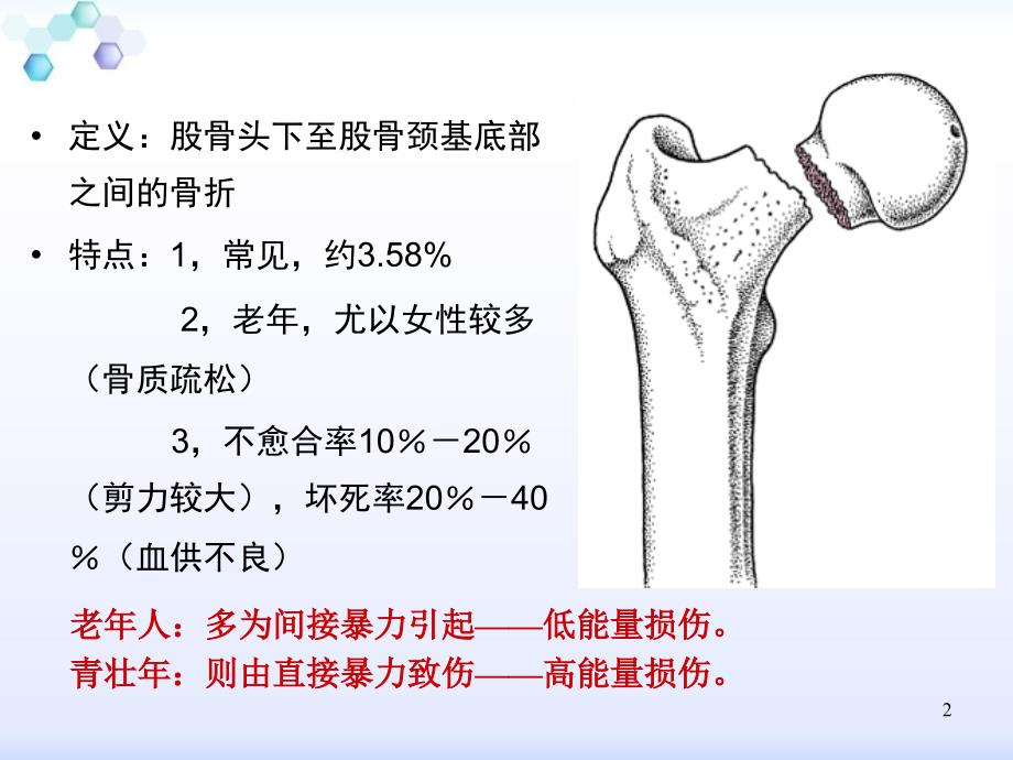 股骨颈骨折骨一科_第2页