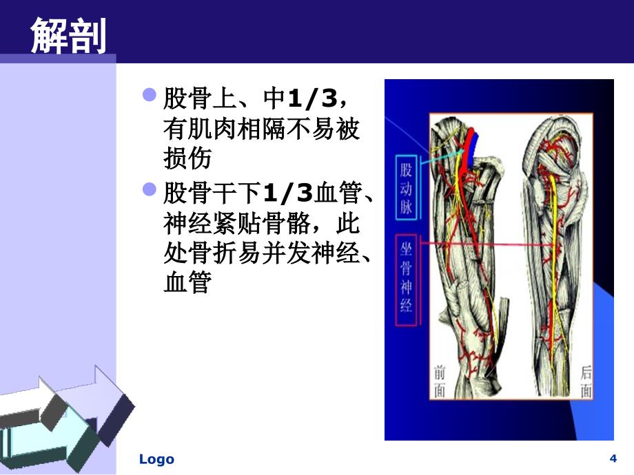 股骨干骨折患者护理_第4页