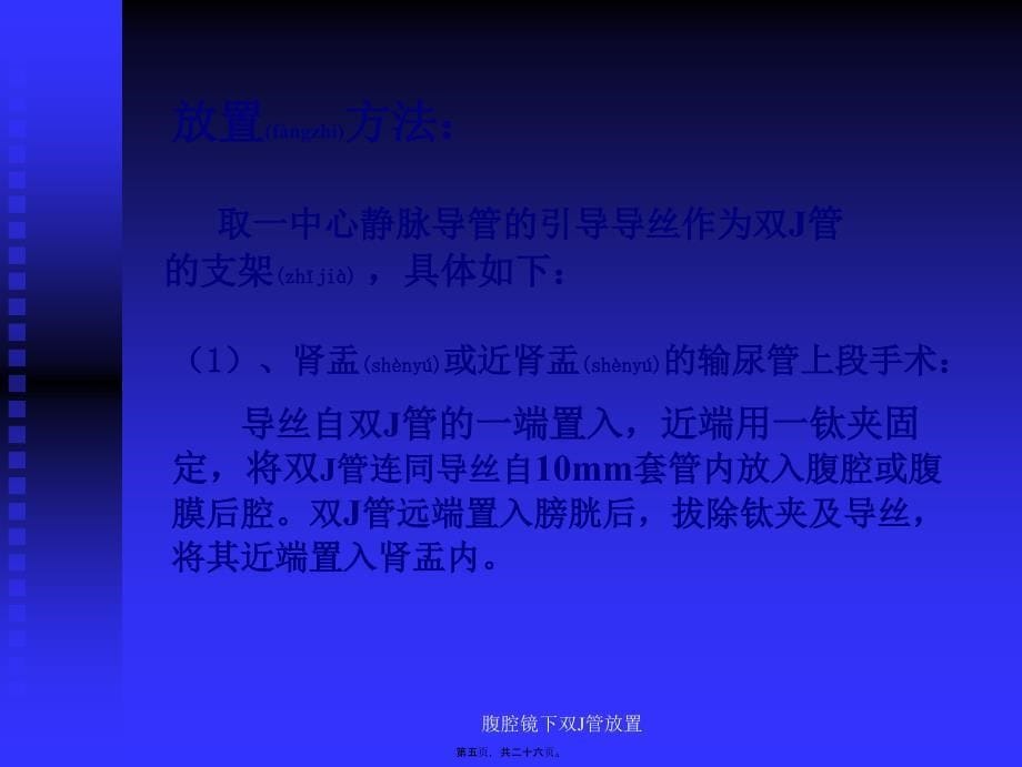 腹腔镜下双J管放置课件_第5页