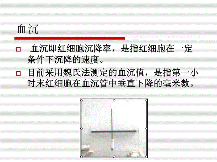 临床部分实验室检测结果意义_第2页