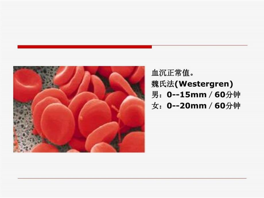 临床部分实验室检测结果意义_第3页