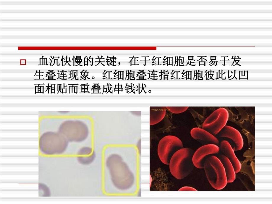 临床部分实验室检测结果意义_第4页