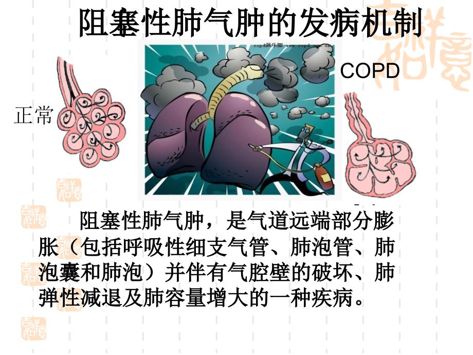 copd发病方法机制与主要研究方法 ppt课件数学_第1页