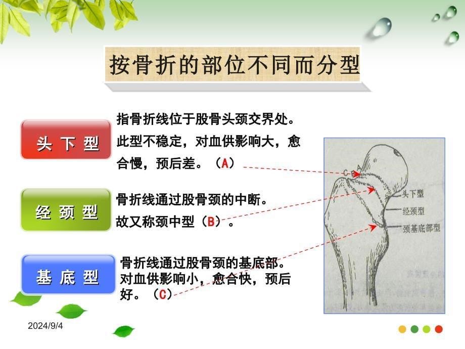 髋关节置换围手术期护理_第5页