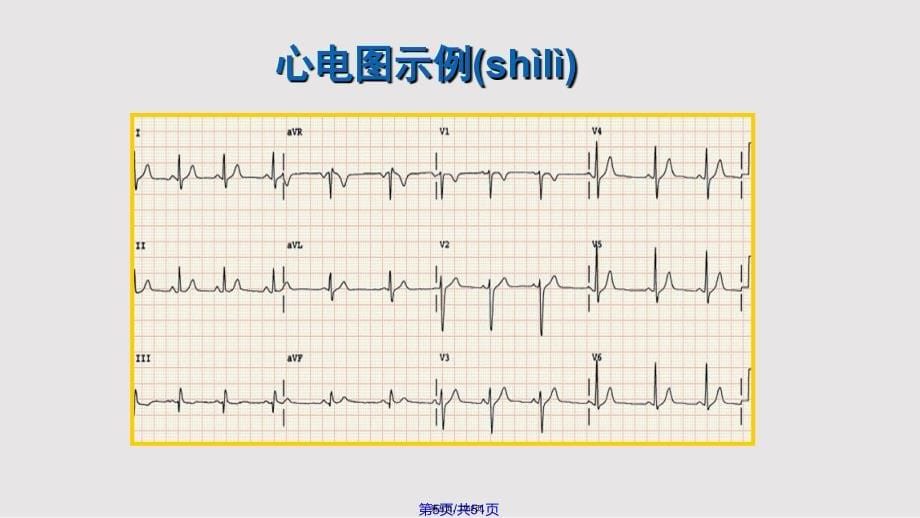 心电图基本知识实用教案_第5页