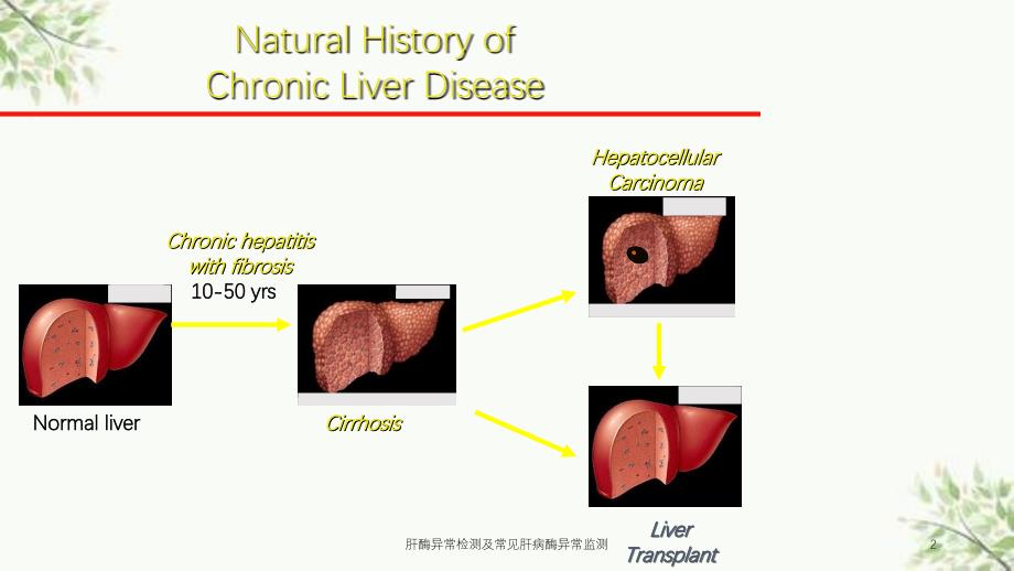 肝酶异常检测及常见肝病酶异常监测课件_第2页