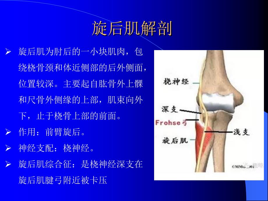 《旋后肌综合征》PPT课件_第2页