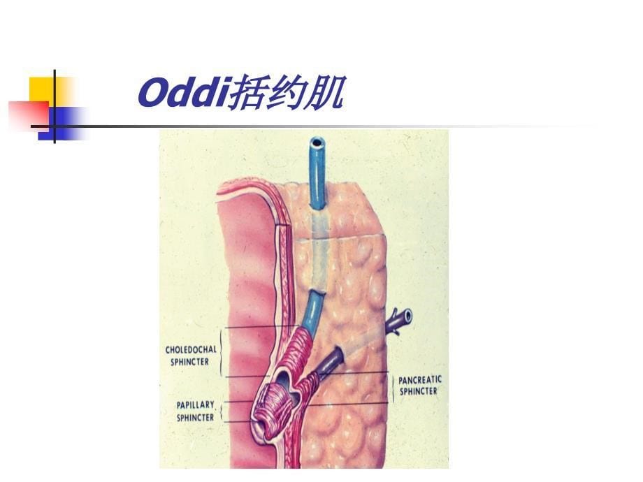 梗阻性黄疸的鉴别诊断_第5页