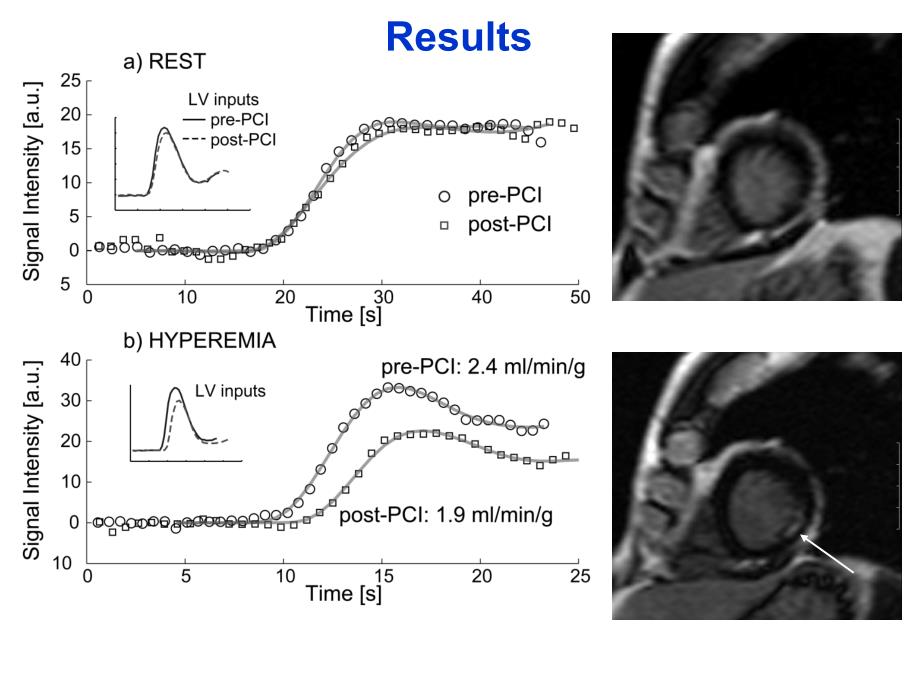 A Quantitative MR Perfusion Study定MR灌注的研究_第4页