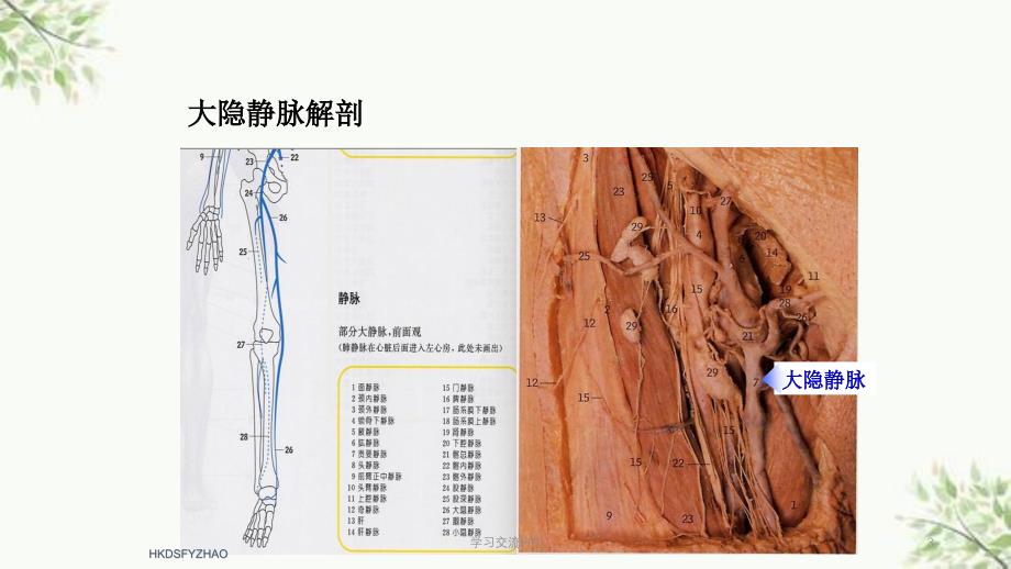 大隐静脉曲张治疗方法课件_第3页