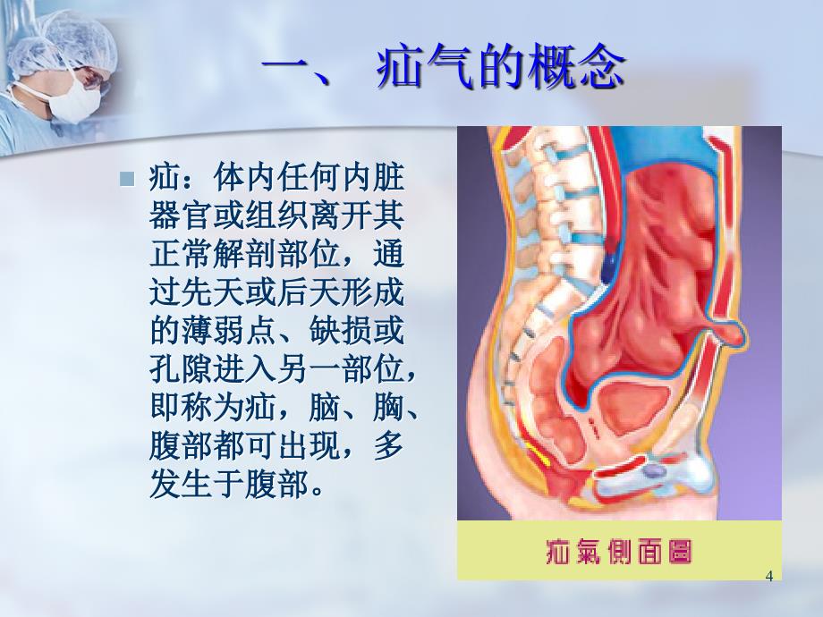 优质课件疝气护理._第4页