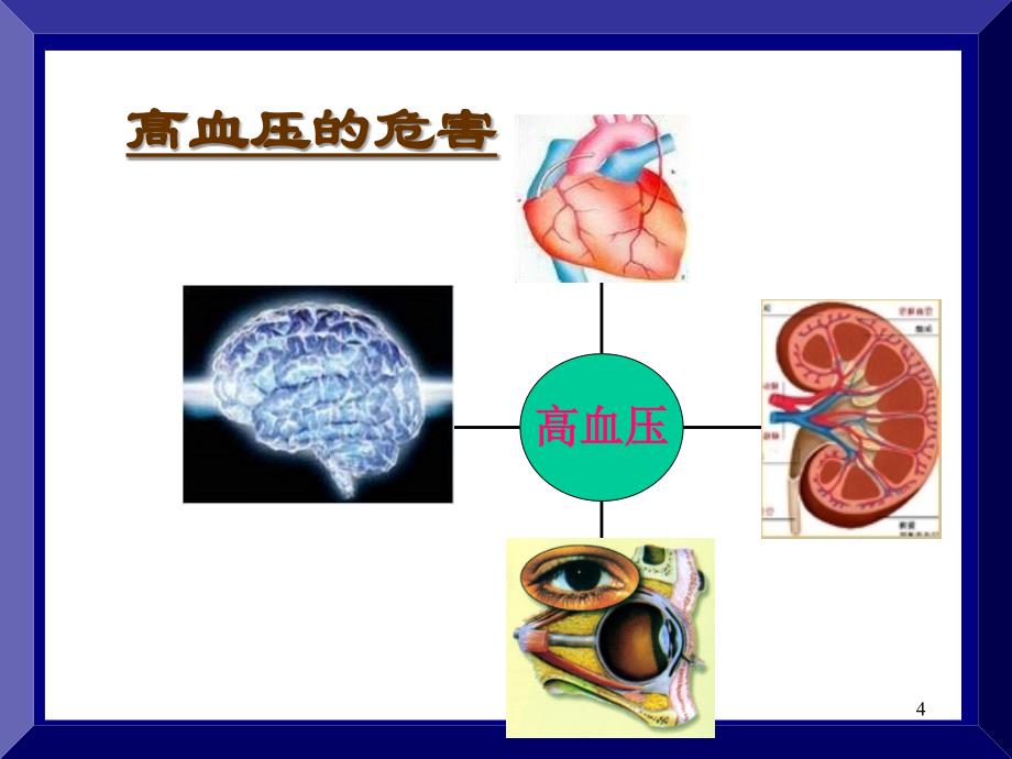 高血压的非药物治疗课件.ppt_第4页