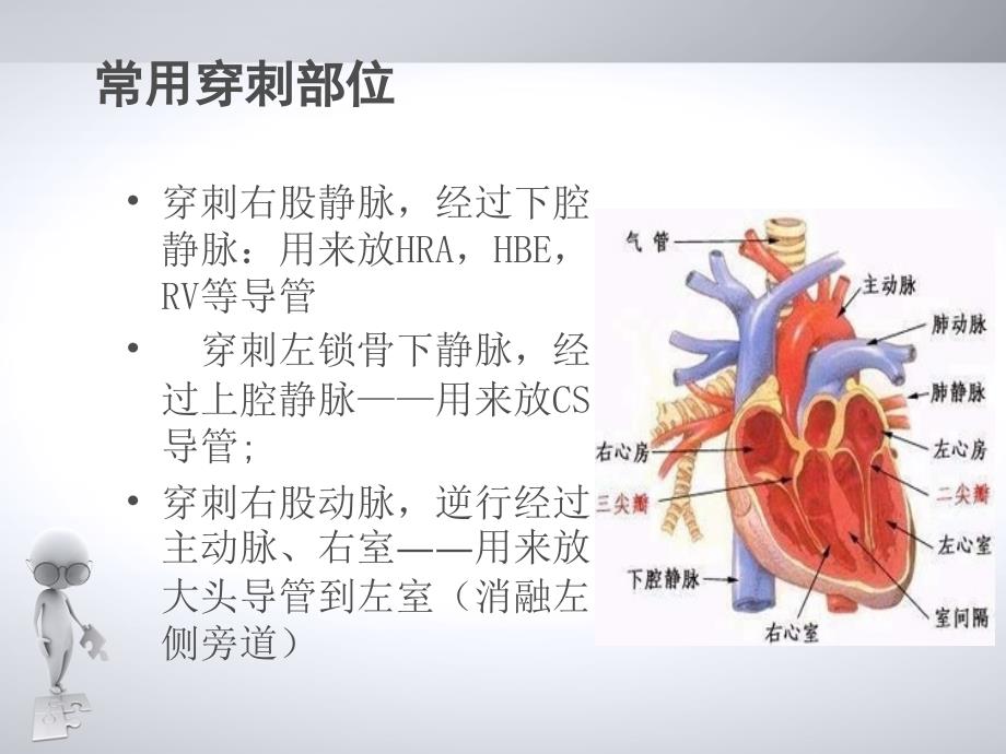 心脏射频消融术护理_第4页