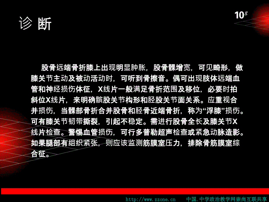 股骨远端骨折 .ppt_第4页