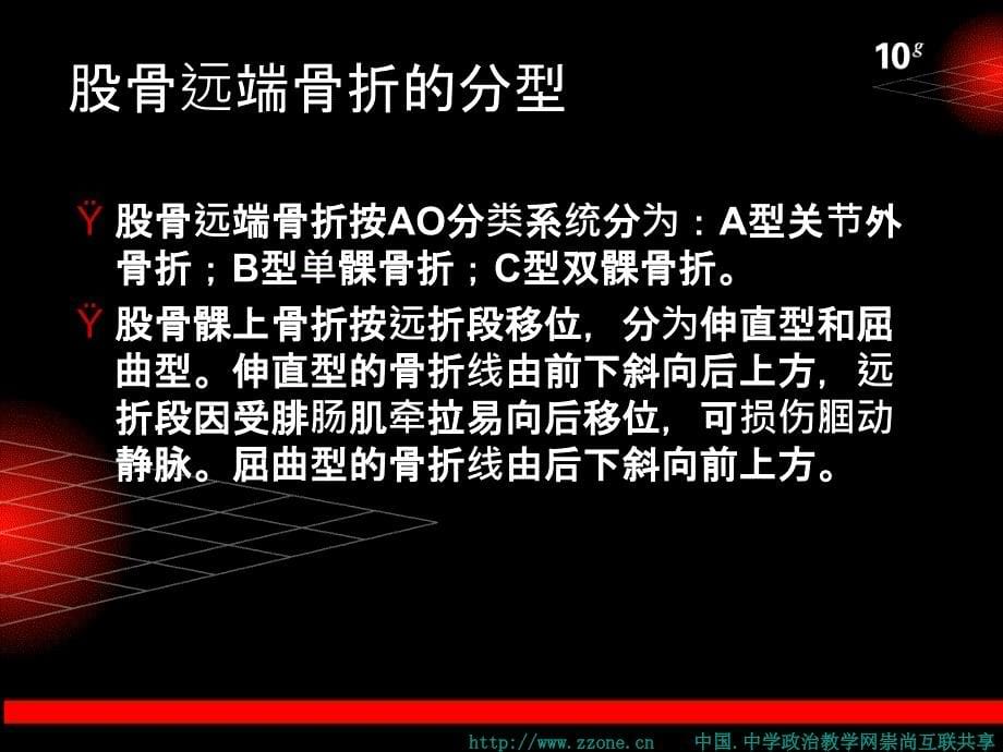 股骨远端骨折 .ppt_第5页