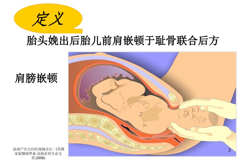 肩难产的临床护理及预防_第2页