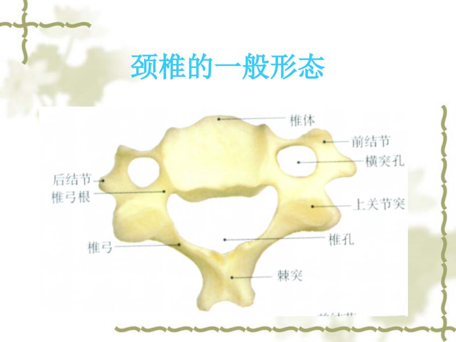 颈椎病的X线征象与临床_第3页