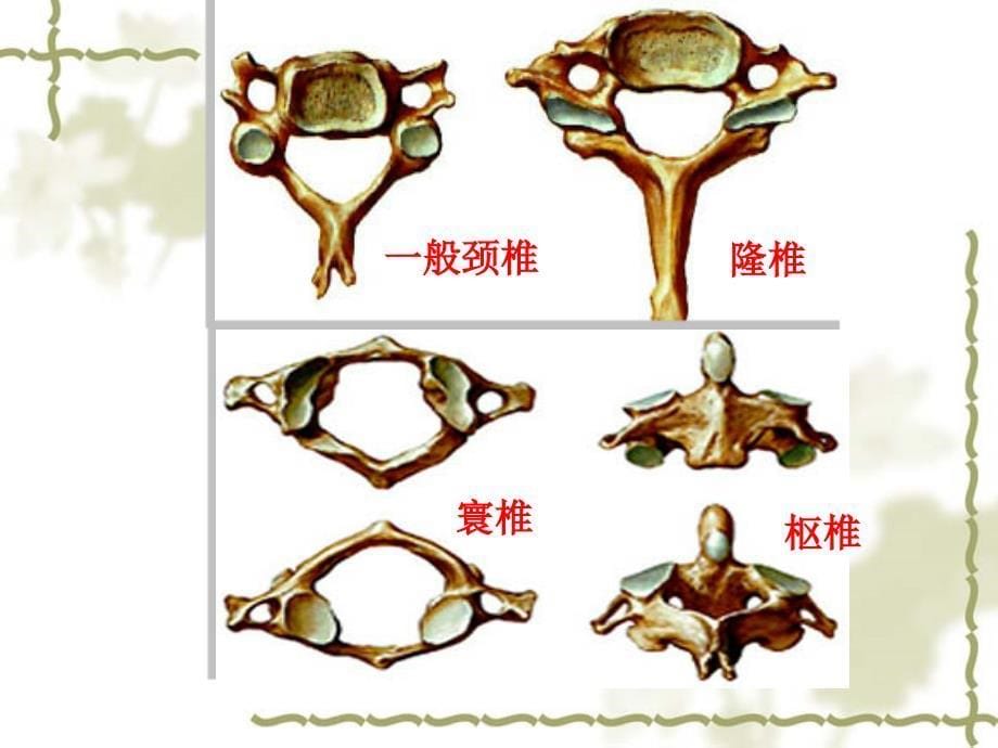 颈椎病的X线征象与临床_第5页