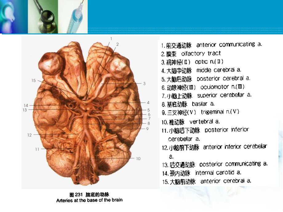 脑血管病脑出血和脑缺血_第4页