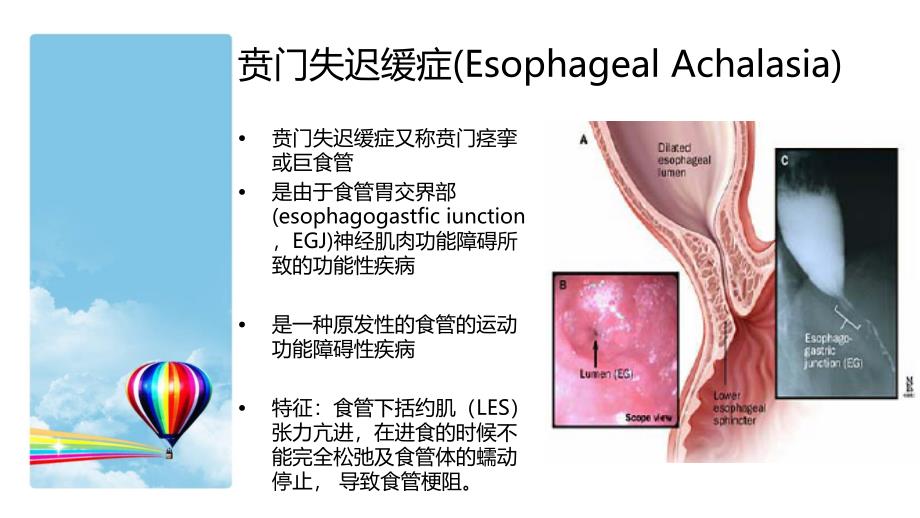 poem术的治疗与护理.ppt_第2页