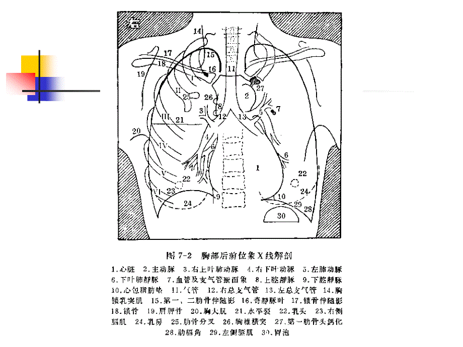 正常胸片胸部CT阅读课件_第4页