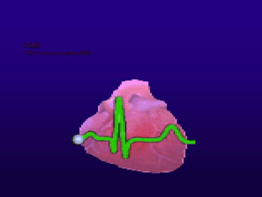 心电图检查ppt课件_第1页