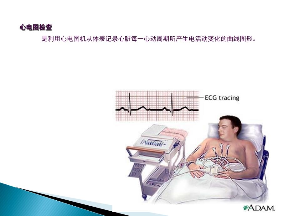 心电图检查ppt课件_第3页