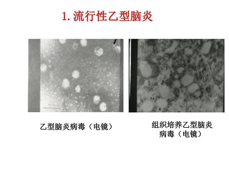 蚊子若的那些祸分析课件_第5页