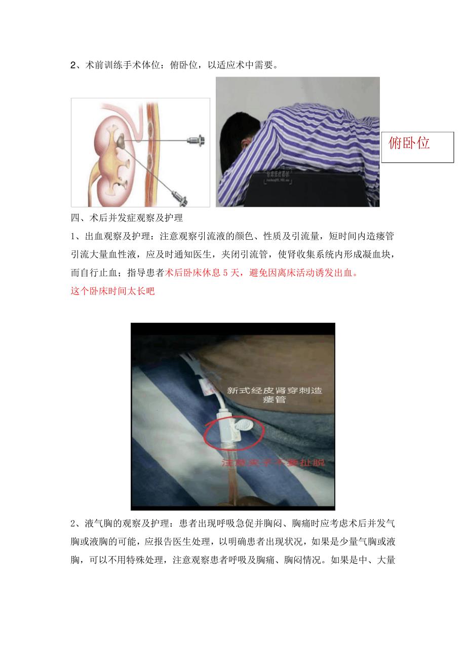 肾盂造瘘患者健康宣教_第2页