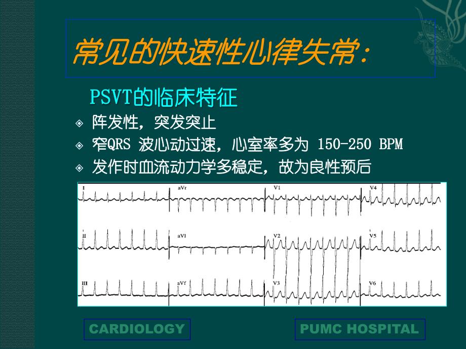 快速性心律失常PPT课件_第3页