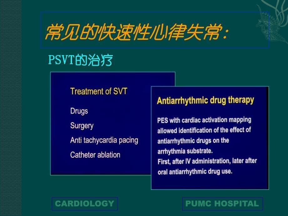 快速性心律失常PPT课件_第5页