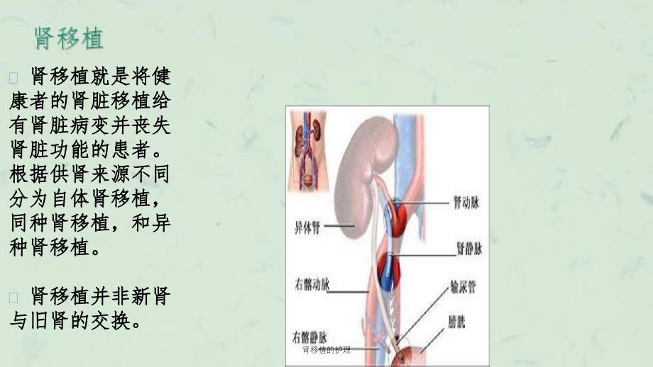 肾移植的护理课件_第3页