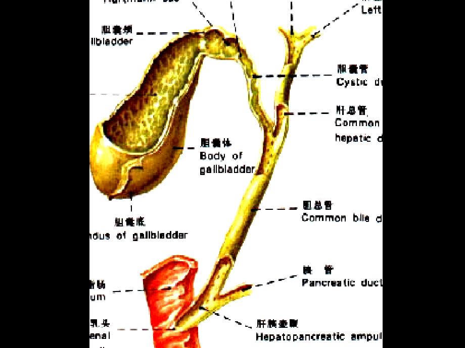 胆道疾病,影像班课程_第4页