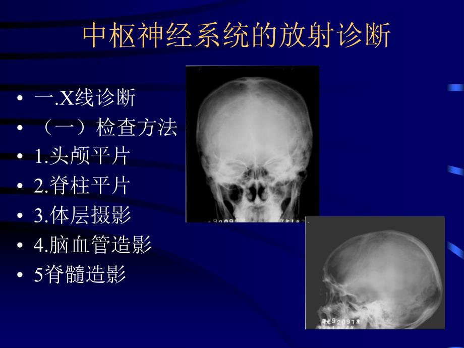 影像诊断神经系统文档资料_第1页