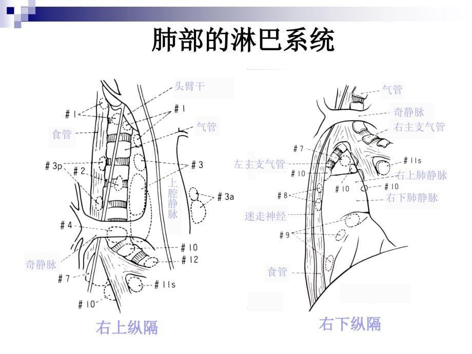 肺癌外科治疗中的系性纵隔淋巴结清扫文档资料_第5页