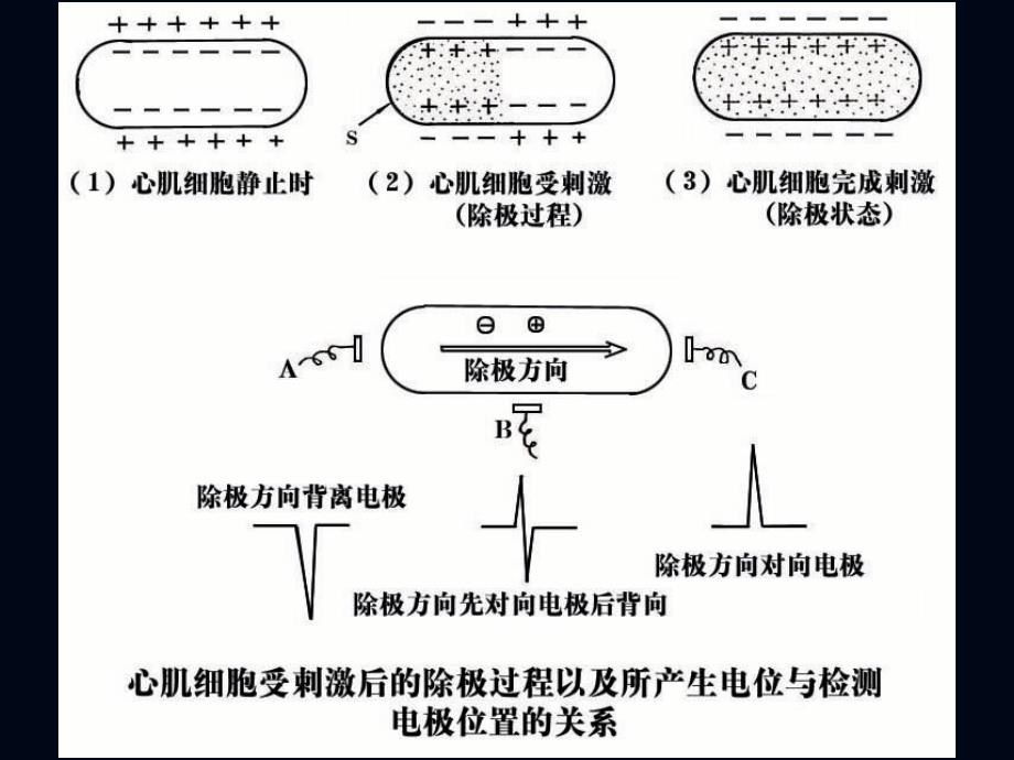 心电图诊断讲座_第4页