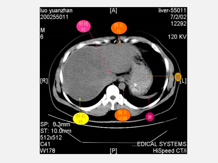 腹部X线诊断PPT演示课件_第3页